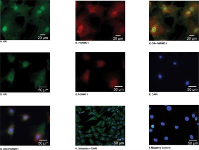 Progestins Inhibit Interleukin-1β-Induced Matrix Metalloproteinase 1 and Interleukin 8 Expression via the Glucocorticoid Receptor in Primary Human Amnion Mesenchymal Cells